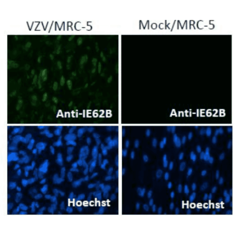 Immunofluorescence staining of VZV IE62 protein in VZV-infected MRC-5 cells by using anti-VZV IE62 antibody (clone 62B).
