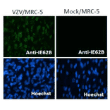 Immunofluorescence staining of VZV IE62 protein in VZV-infected MRC-5 cells by using anti-VZV IE62 antibody (clone 62B).