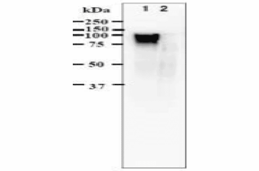 blotting using anti-VZV gE antibody (clone #9). Identification of gE protein in VZV-infected cells by western 