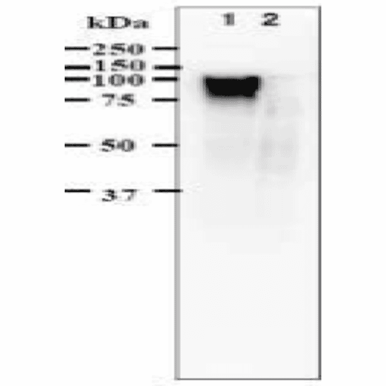 blotting using anti-VZV gE antibody (clone #9). Identification of gE protein in VZV-infected cells by western 