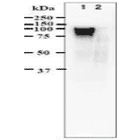 blotting using anti-VZV gE antibody (clone #9). Identification of gE protein in VZV-infected cells by western 