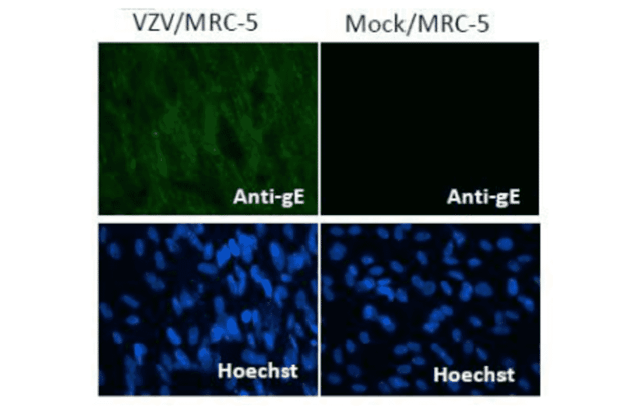 Immunofluorescence staining of VZV gE protein in VZV-infected MRC-5 cells by using anti-VZV gE antibody (clone #9). 