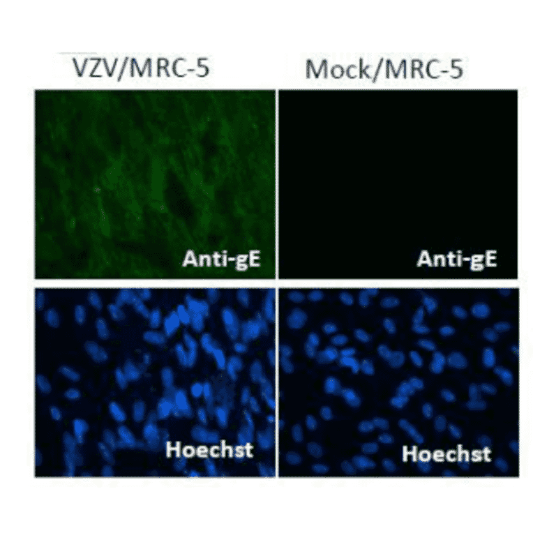 Immunofluorescence staining of VZV gE protein in VZV-infected MRC-5 cells by using anti-VZV gE antibody (clone #9). 
