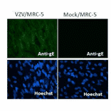Immunofluorescence staining of VZV gE protein in VZV-infected MRC-5 cells by using anti-VZV gE antibody (clone #9). 