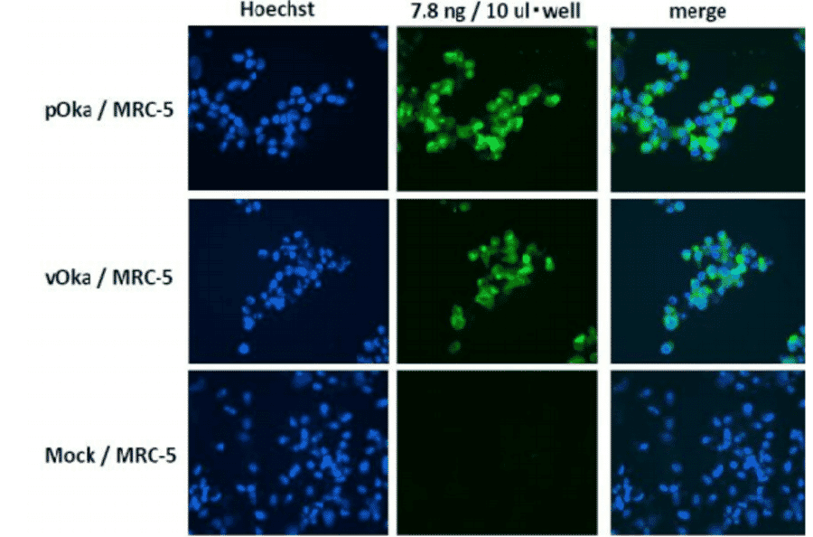 Figure. Immunofluorescence staining of VZV glycoprotein H in VZV-infected MRC-5 cells by using anti-VZV gH antibody (clone OAKK39). MRC-5 was infected with VZV pOka strain, vaccine strai vOka or mock-infected. Anti-VZV gH antibody was used at about 1/1,000 dilution. As second antibody, Alexa Fluor 488 donkey anti-mouse IgG [H+L] (Life Technology No. A21202) was used at 1/200 dilution. Nuclei were stained with Hoechst 33342. 