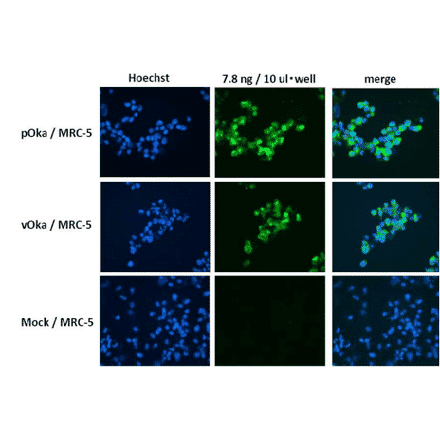 Figure. Immunofluorescence staining of VZV glycoprotein H in VZV-infected MRC-5 cells by using anti-VZV gH antibody (clone OAKK39). MRC-5 was infected with VZV pOka strain, vaccine strai vOka or mock-infected. Anti-VZV gH antibody was used at about 1/1,000 dilution. As second antibody, Alexa Fluor 488 donkey anti-mouse IgG [H+L] (Life Technology No. A21202) was used at 1/200 dilution. Nuclei were stained with Hoechst 33342. 