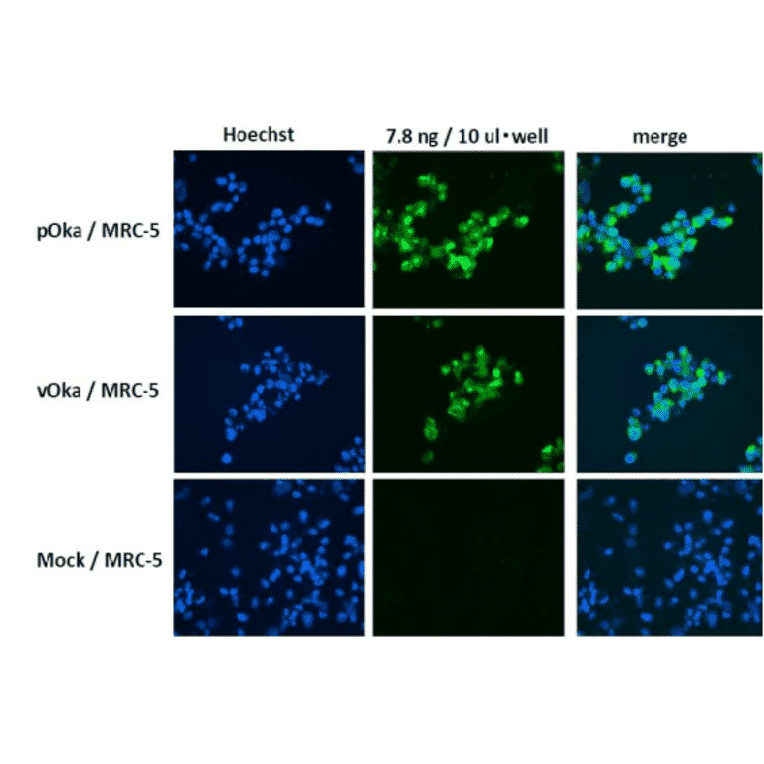 Figure. Immunofluorescence staining of VZV glycoprotein H in VZV-infected MRC-5 cells by using anti-VZV gH antibody (clone OAKK39). MRC-5 was infected with VZV pOka strain, vaccine strai vOka or mock-infected. Anti-VZV gH antibody was used at about 1/1,000 dilution. As second antibody, Alexa Fluor 488 donkey anti-mouse IgG [H+L] (Life Technology No. A21202) was used at 1/200 dilution. Nuclei were stained with Hoechst 33342. 