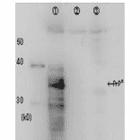Figure. Identification of Prion protein in crude cell extract by Western blotting using the monoclonal antibody 2C5-5. Lane 1: Extract of rabbit kidney cells RK13 over-expressing prion protein Lane 2: Negative control; extract of the vector infected cells Lane 3: Negative control; extract of RK13 cells