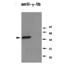 Identifiction of endogenous ?-tubulin in a Xenopus mitotic extract by western blot