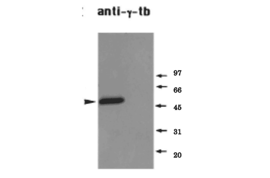 Identifiction of endogenous ?-tubulin in a Xenopus mitotic extract by western blot