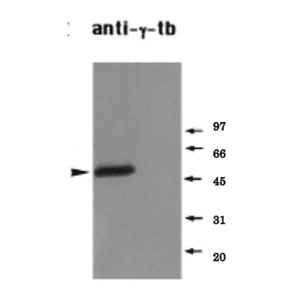 Identifiction of endogenous ?-tubulin in a Xenopus mitotic extract by western blot
