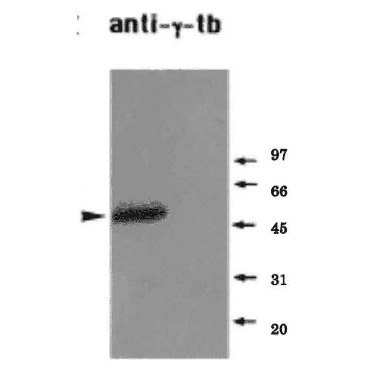 Identifiction of endogenous ?-tubulin in a Xenopus mitotic extract by western blot