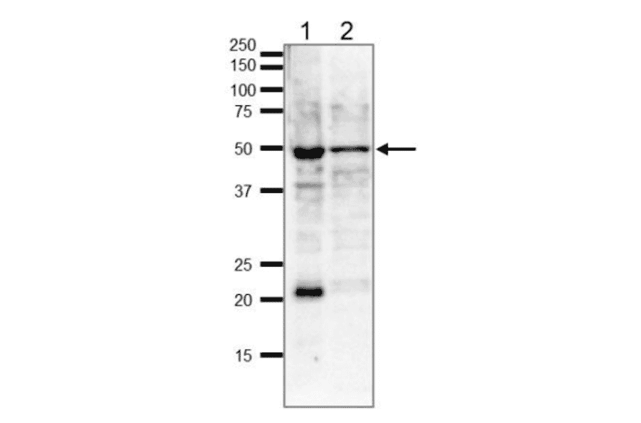 Identifiction of endogeneous ?-tubulin in whole cell extracts by western blot .