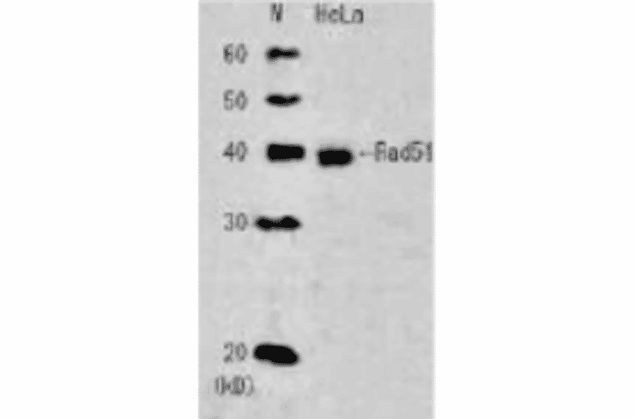 Detection of endogenous Rad51 in whole cell extract of HeLa cells. Anti-Rad51 Antibody was used at 1:2,000 dilution.