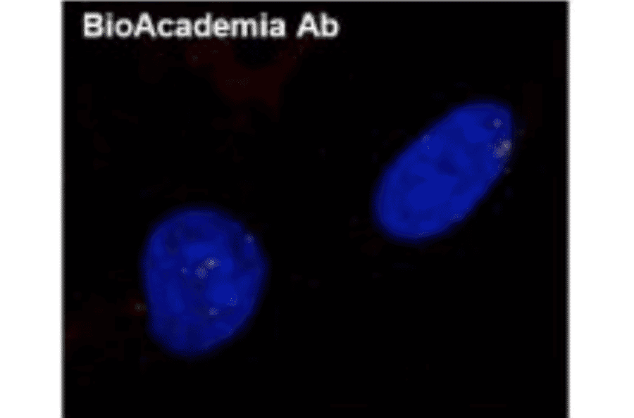 Detection of Rad51 foci: formation induced by DNA damage. Normal human diploid cells were irradiated by X-ray (0.5 Gy) and after 6 hr incubation, the cells were fixed and immunostained by using Anti-Rad51 Antibody (1:100 dilution) as the primary antibody and Anti-Rabbit IgG Antibody (Alexa 594) as the secondary antibody.