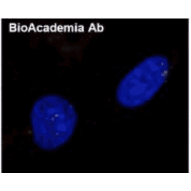 Detection of Rad51 foci: formation induced by DNA damage. Normal human diploid cells were irradiated by X-ray (0.5 Gy) and after 6 hr incubation, the cells were fixed and immunostained by using Anti-Rad51 Antibody (1:100 dilution) as the primary antibody and Anti-Rabbit IgG Antibody (Alexa 594) as the secondary antibody.