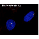 Detection of Rad51 foci: formation induced by DNA damage. Normal human diploid cells were irradiated by X-ray (0.5 Gy) and after 6 hr incubation, the cells were fixed and immunostained by using Anti-Rad51 Antibody (1:100 dilution) as the primary antibody and Anti-Rabbit IgG Antibody (Alexa 594) as the secondary antibody.