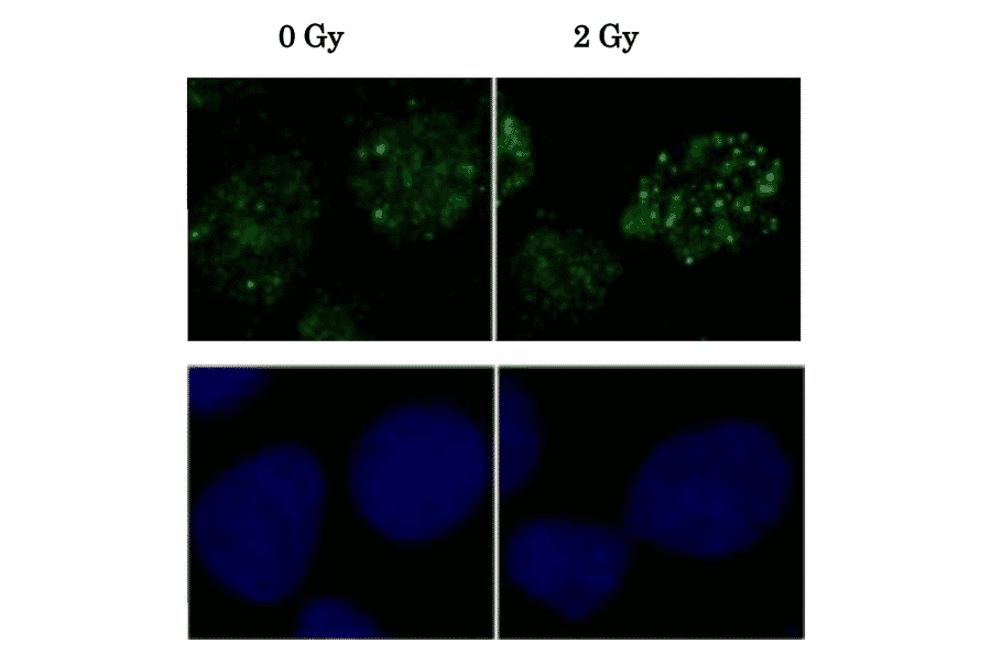 Induction of Rad51 foci formation by X-ray Irradiation. Human osteosarcoma U2OS cells X-ray irradiation before and 2h after were immunostained with the Anti-Rad51 Antibody at 1:6,000 dilution. The lower panels were the same cells with Hoechst.