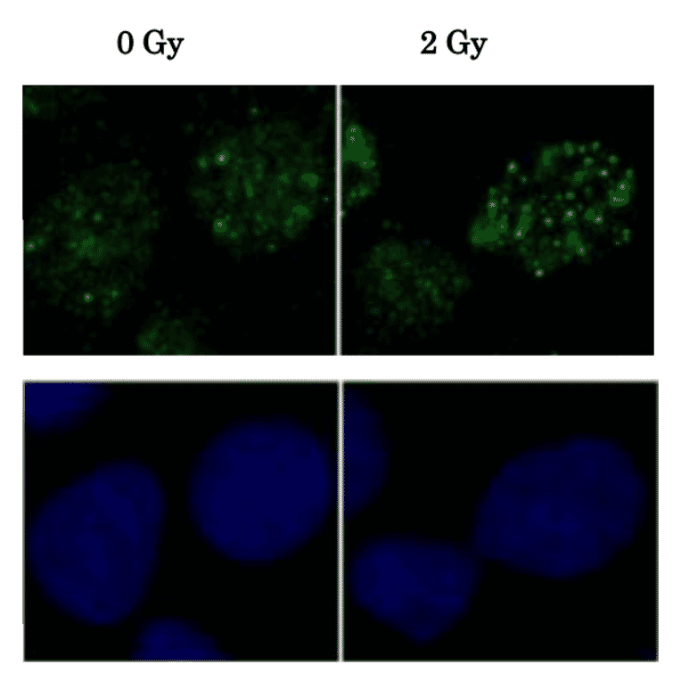 Induction of Rad51 foci formation by X-ray Irradiation. Human osteosarcoma U2OS cells X-ray irradiation before and 2h after were immunostained with the Anti-Rad51 Antibody at 1:6,000 dilution. The lower panels were the same cells with Hoechst.