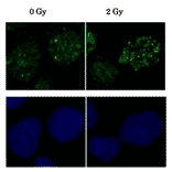 Induction of Rad51 foci formation by X-ray Irradiation. Human osteosarcoma U2OS cells X-ray irradiation before and 2h after were immunostained with the Anti-Rad51 Antibody at 1:6,000 dilution. The lower panels were the same cells with Hoechst.