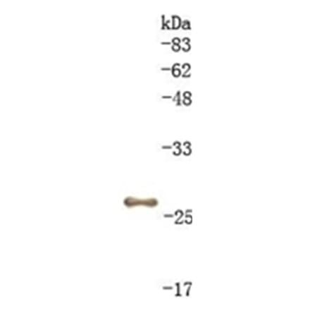 Western Blot - Anti-GST Antibody (010804C10) - Antibodies.com