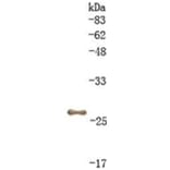 Western Blot - Anti-GST Antibody (010804C10) - Antibodies.com