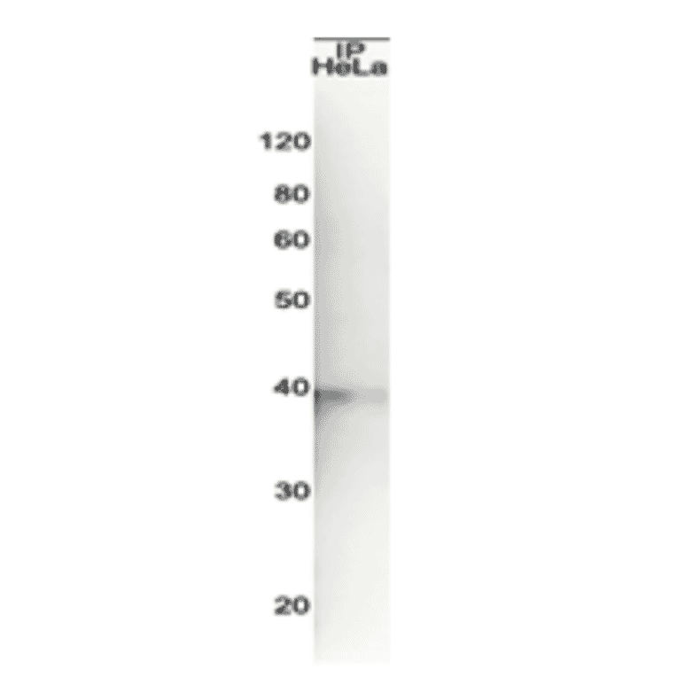 Immunoprecipitation of Rad51 from crude extract of HeLa cells Rad51 was immunoprecipitated from HeLa cell extract, 20 µg, with anti-Rad51 IgY conjugated to Sepharose 4B and the eluate was immunoblotted with rabbit anti-Rad51 antibody (BioAcademia 70-012)