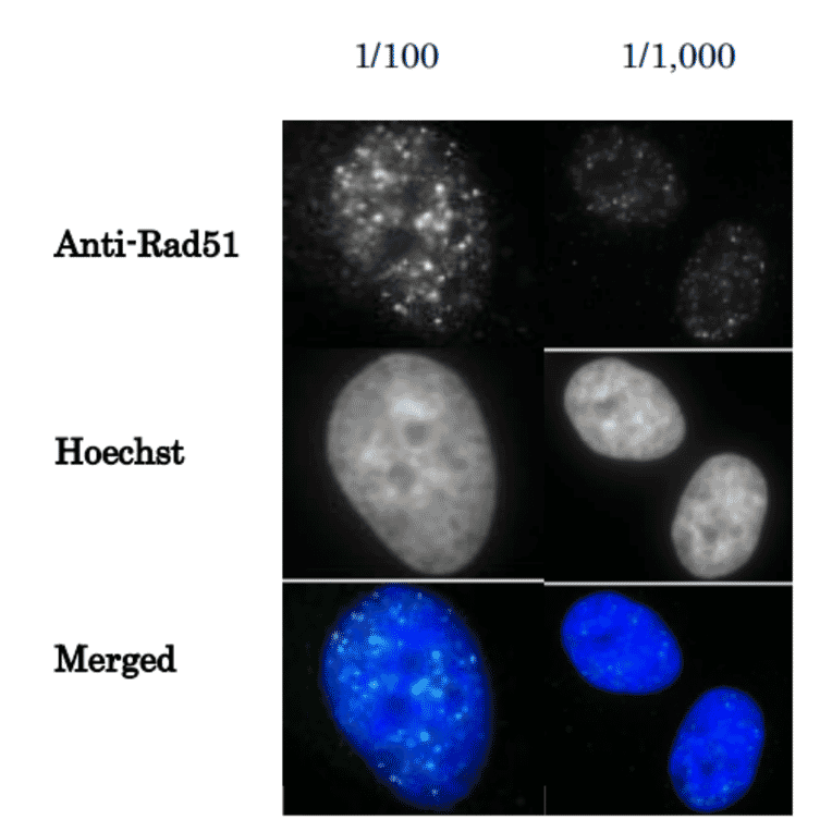 Detection of Rad51 protein foci formation with Anti-Rad51 Antibody in X-ray irradiated human fibroblast cells, GM0637. 1) The cells were irradiated with X-ray at 2 Gy, grown for 1 hr, fixed with 4% paraformaldehyde for 10 min and washed with PBS three times. 2) Permeabilized by treatment with 0.5% Triton for 5 min and washed with PBS three times. 3) Incubated with Anti-Rad51 Antibody at 1:100 dilution or 1:1,000 dilution for 30 min at 37°C and washed with PBS three times. 4) Anti-Chicken IgY Antibody (Alexa488) was used as a secondary at 1:5,000 dilution.