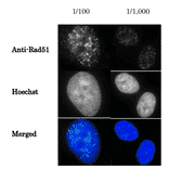 Detection of Rad51 protein foci formation with Anti-Rad51 Antibody in X-ray irradiated human fibroblast cells, GM0637. 1) The cells were irradiated with X-ray at 2 Gy, grown for 1 hr, fixed with 4% paraformaldehyde for 10 min and washed with PBS three times. 2) Permeabilized by treatment with 0.5% Triton for 5 min and washed with PBS three times. 3) Incubated with Anti-Rad51 Antibody at 1:100 dilution or 1:1,000 dilution for 30 min at 37°C and washed with PBS three times. 4) Anti-Chicken IgY Antibody (Alexa488) was used as a secondary at 1:5,000 dilution.