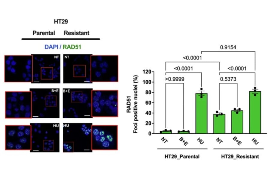 immunofluorescence - Anti-Rad51 Antibody (A351) - Antibodies.com Citation