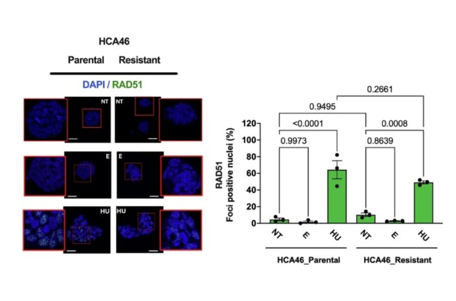 immunofluorescence - Anti-Rad51 Antibody (A351) - Antibodies.com Citation
