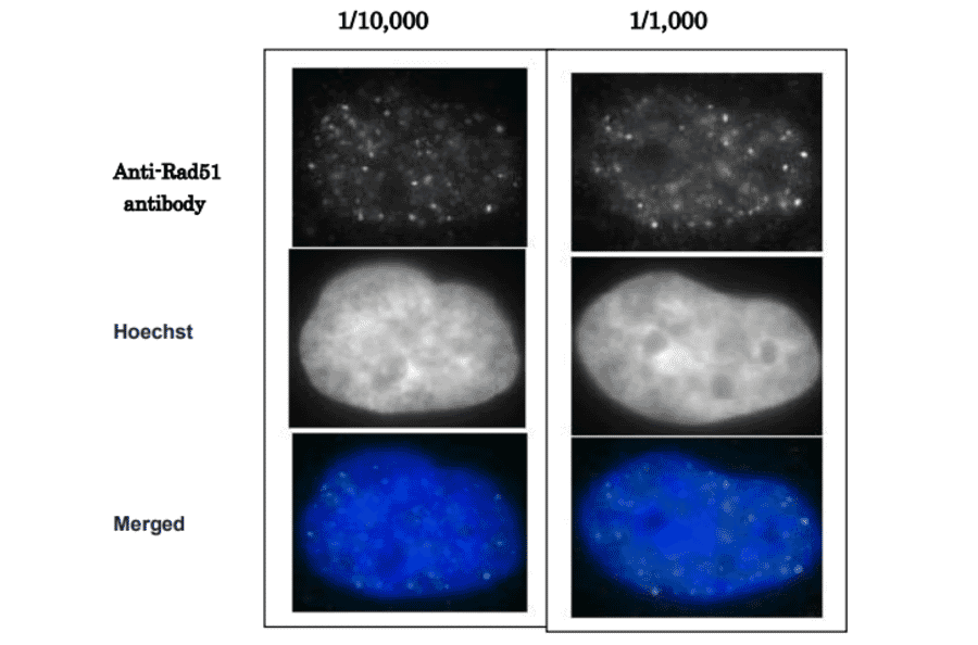 Detection of Rad51 foci formation after X-ray irradiation in human fibroblast cell line, GM0637. Cells were irradiated by X-rays at 2 Gy, grown for 1 hr, fixed with 4% paraformaldehyde in 1x PBS for 10 min, washed 3 times with PBS for 3 min, permealized by treatment with 0.5% Triton for 5 min, washed 3 times with PBS for 3 min, incubated with Anti-Rad51 Antibody for 30 min at 37°C, washed 3 times with PBS for 3 min, incubated with secondary antibody for 30 min at 37°C, washed 3 times with PBS for 3 min, stained with Hoechst for 1 min and mounted. Anti-Rad51 Antibody was used at 1:10,000 dilution (left panels) and 1:1,000 dilution (right panels). Anti-Rabbit IgG Antibody (Alexa 488) was used as a secondary at 1:10,000 dilution.