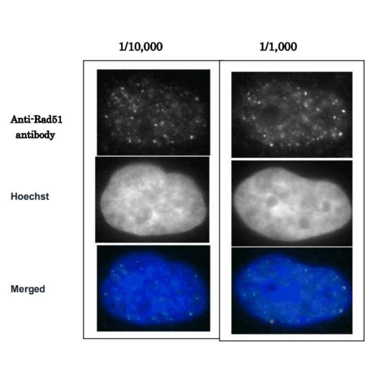 Detection of Rad51 foci formation after X-ray irradiation in human fibroblast cell line, GM0637. Cells were irradiated by X-rays at 2 Gy, grown for 1 hr, fixed with 4% paraformaldehyde in 1x PBS for 10 min, washed 3 times with PBS for 3 min, permealized by treatment with 0.5% Triton for 5 min, washed 3 times with PBS for 3 min, incubated with Anti-Rad51 Antibody for 30 min at 37°C, washed 3 times with PBS for 3 min, incubated with secondary antibody for 30 min at 37°C, washed 3 times with PBS for 3 min, stained with Hoechst for 1 min and mounted. Anti-Rad51 Antibody was used at 1:10,000 dilution (left panels) and 1:1,000 dilution (right panels). Anti-Rabbit IgG Antibody (Alexa 488) was used as a secondary at 1:10,000 dilution.