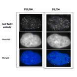 Detection of Rad51 foci formation after X-ray irradiation in human fibroblast cell line, GM0637. Cells were irradiated by X-rays at 2 Gy, grown for 1 hr, fixed with 4% paraformaldehyde in 1x PBS for 10 min, washed 3 times with PBS for 3 min, permealized by treatment with 0.5% Triton for 5 min, washed 3 times with PBS for 3 min, incubated with Anti-Rad51 Antibody for 30 min at 37°C, washed 3 times with PBS for 3 min, incubated with secondary antibody for 30 min at 37°C, washed 3 times with PBS for 3 min, stained with Hoechst for 1 min and mounted. Anti-Rad51 Antibody was used at 1:10,000 dilution (left panels) and 1:1,000 dilution (right panels). Anti-Rabbit IgG Antibody (Alexa 488) was used as a secondary at 1:10,000 dilution.