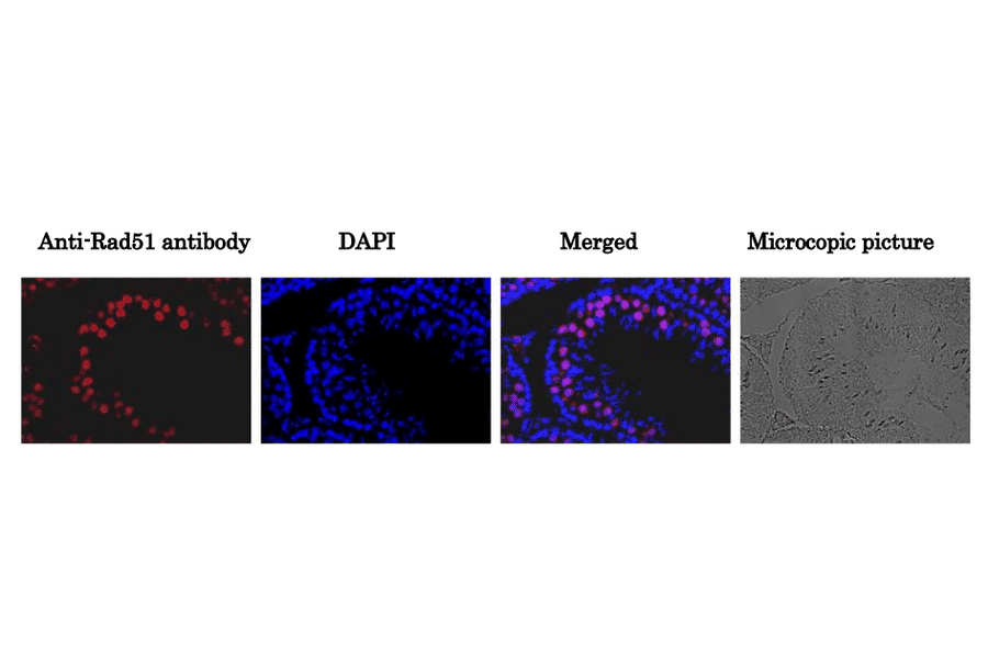 Immunohistological staining of Rad51 protein in mouse testis using Anti-Rad51 Antibody. A section of formalin fixed and paraffin embedded mouse testis was treated with the Anti-Rad51 Antibody at 1:100 dilution after deparaffization and antigen retrieval. Anti-Rabbit IgG Antibody (Alexa Fluor 647) was used at 1:1,000 dilution. DNA was stained with DAPI and the merged image was shown (Merged). The plain black and white microsopic picture of the same region was shown on the right.