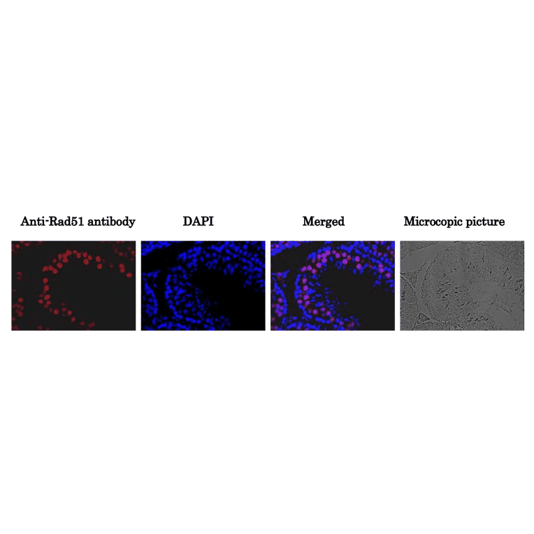 Immunohistological staining of Rad51 protein in mouse testis using Anti-Rad51 Antibody. A section of formalin fixed and paraffin embedded mouse testis was treated with the Anti-Rad51 Antibody at 1:100 dilution after deparaffization and antigen retrieval. Anti-Rabbit IgG Antibody (Alexa Fluor 647) was used at 1:1,000 dilution. DNA was stained with DAPI and the merged image was shown (Merged). The plain black and white microsopic picture of the same region was shown on the right.