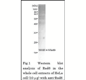 Western blot analysis of Rad6 in the whole cell extracts of Hela cell (10µg) with Anti-Rad6 Antibody.