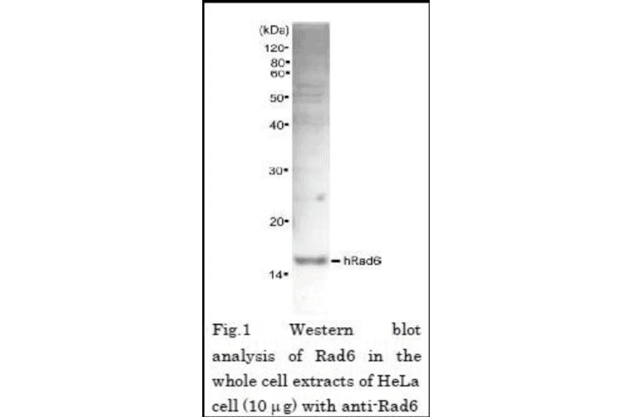 Western blot analysis of Rad6 in the whole cell extracts of Hela cell (10µg) with Anti-Rad6 Antibody.