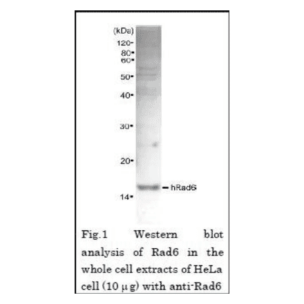 Western blot analysis of Rad6 in the whole cell extracts of Hela cell (10µg) with Anti-Rad6 Antibody.