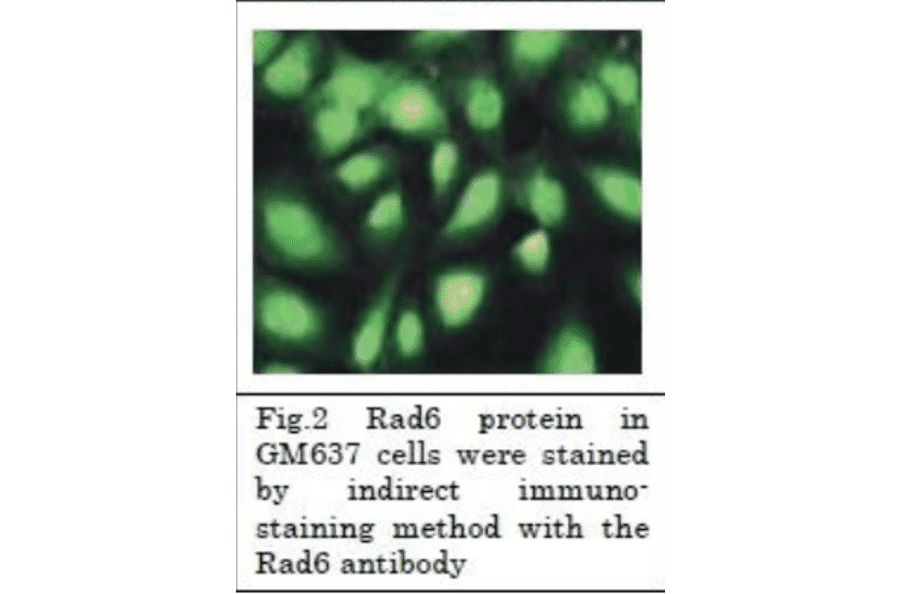 Rad6 protein in GM 637 cells were stained by indirect immunostaining method with Anti-Rad6 Antibody.