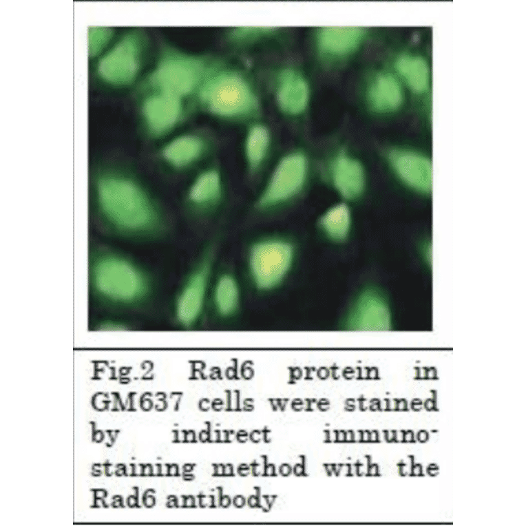 Rad6 protein in GM 637 cells were stained by indirect immunostaining method with Anti-Rad6 Antibody.