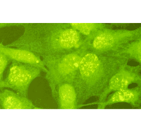 Indirect immunofluorescence staining of Rad18 protein in GM637 cells. Rad18 protein is stained as yellow dots in nuclei.