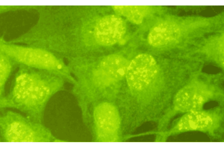 Indirect immunofluorescence staining of Rad18 protein in GM637 cells. Rad18 protein is stained as yellow dots in nuclei.