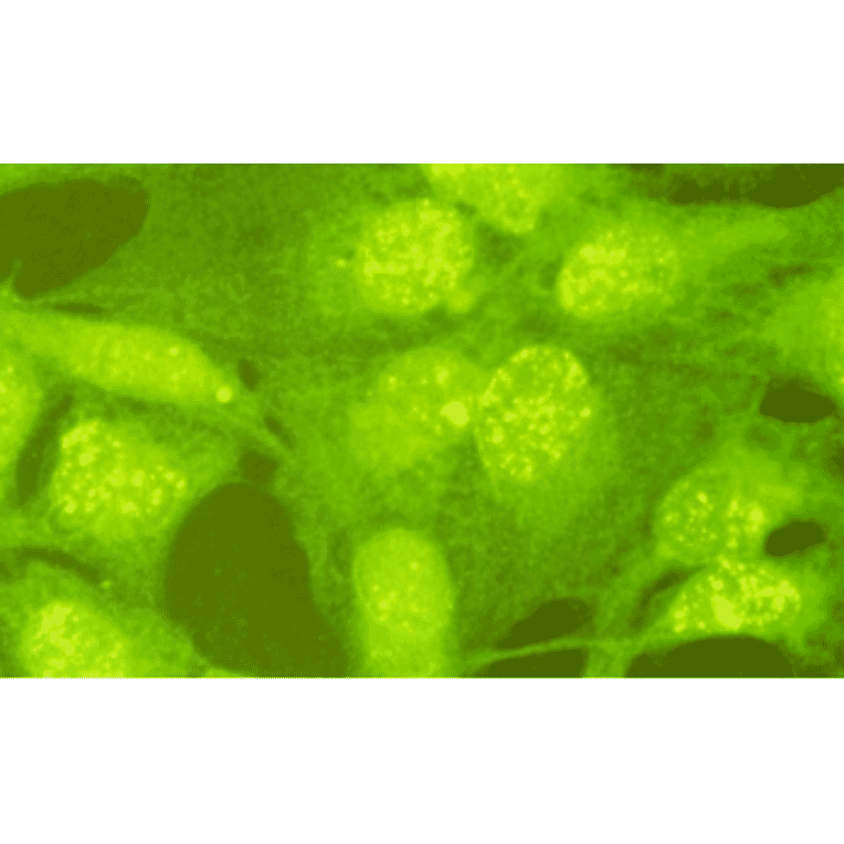 Indirect immunofluorescence staining of Rad18 protein in GM637 cells. Rad18 protein is stained as yellow dots in nuclei.