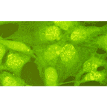 Indirect immunofluorescence staining of Rad18 protein in GM637 cells. Rad18 protein is stained as yellow dots in nuclei.