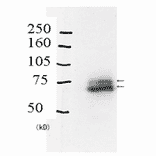 Identification of Rad18 protein in crude extract of A549 cells by western blotting with Anti-Rad18 Antibody. The primary and secondary antibodies are used at 1:1,000 and 1:20,000 dilutions, respectively. The lower thick band is native Rad18 and the upper thin band is mono-ubiquitinated Rad18.