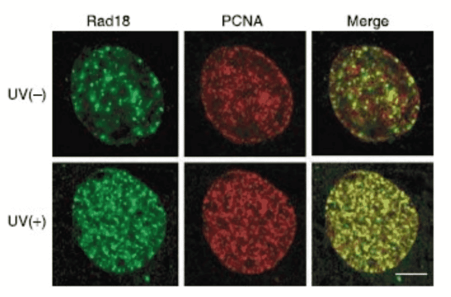 Colocalization of Rad18 with PCNA on chromatin following UV irradiation. UV-induced colocalization of Rad18 (green) with PCNA (red). GM637 cells irradiated at 15/m2 were fixed with methnol 4h after UV irradiation and immunostained with Anti-Rad18 Antibody and Anti-PCNA Antibody and processed for double staining. Anti-Rad18 Antibody was used at 1:250 dilution and Goat Anti-Rabbit IgG Antibody (Alexa Fluor 488) was used as a secondary at 4µg/ml.