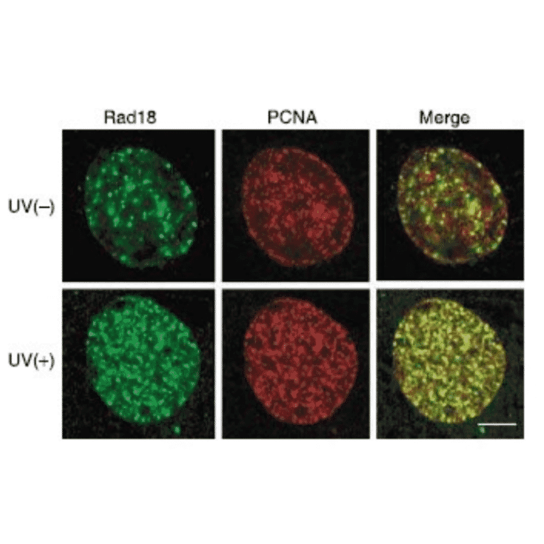 Colocalization of Rad18 with PCNA on chromatin following UV irradiation. UV-induced colocalization of Rad18 (green) with PCNA (red). GM637 cells irradiated at 15/m2 were fixed with methnol 4h after UV irradiation and immunostained with Anti-Rad18 Antibody and Anti-PCNA Antibody and processed for double staining. Anti-Rad18 Antibody was used at 1:250 dilution and Goat Anti-Rabbit IgG Antibody (Alexa Fluor 488) was used as a secondary at 4µg/ml.