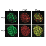 Colocalization of Rad18 with PCNA on chromatin following UV irradiation. UV-induced colocalization of Rad18 (green) with PCNA (red). GM637 cells irradiated at 15/m2 were fixed with methnol 4h after UV irradiation and immunostained with Anti-Rad18 Antibody and Anti-PCNA Antibody and processed for double staining. Anti-Rad18 Antibody was used at 1:250 dilution and Goat Anti-Rabbit IgG Antibody (Alexa Fluor 488) was used as a secondary at 4µg/ml.