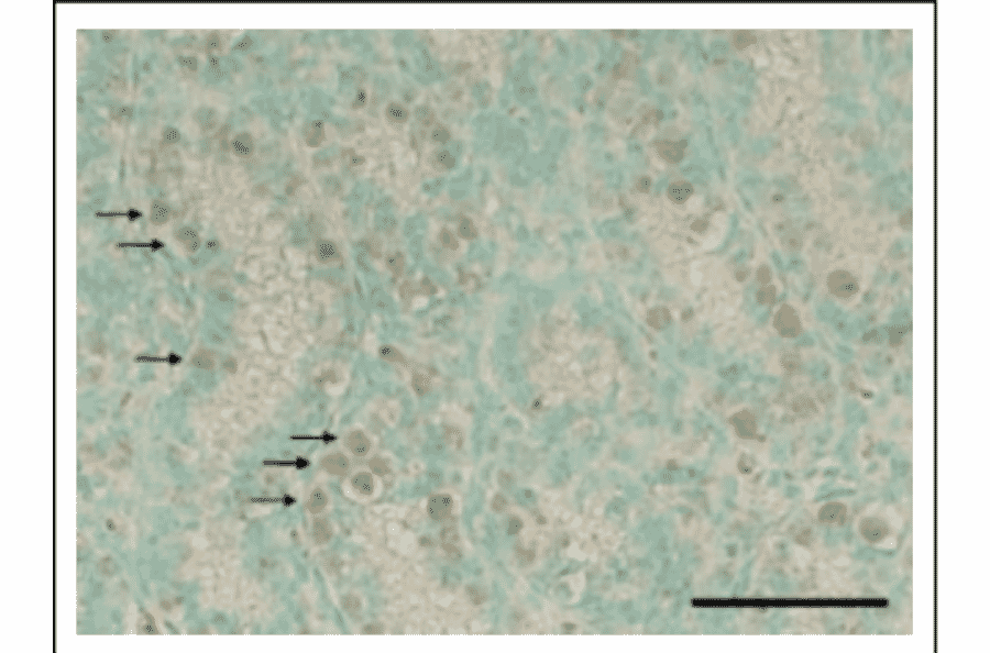 Detection of Rad18 in mouse testis. Section of paraformaldehyde fixed mouse was stained with Anti-Rad18 Antibody. Donkey Anti-Rabbit IgG Antibody (HRP) was used as a secondary antibody. Signals were enhanced with TSA plus biotin system and detected by using DAB substrate. Arrows indicate undifferentiated spermatogonia.